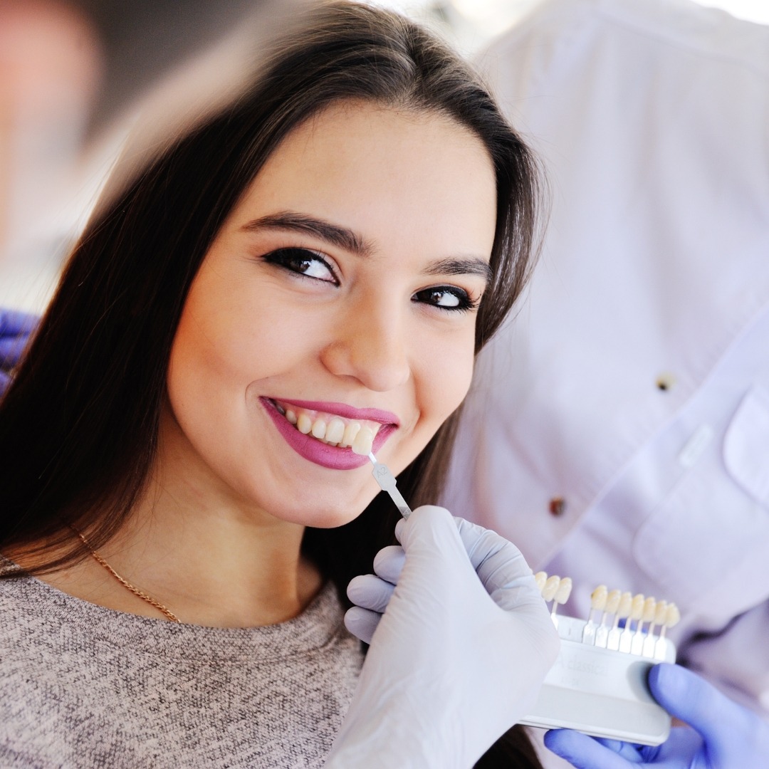 Veneers Gone Wrong Avoiding Common Pitfalls Stoney Creek Family Dental