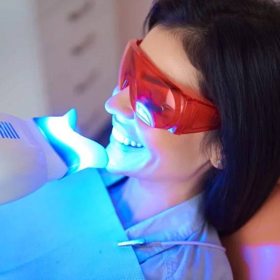 cosmetic bonding vs teeth whitening